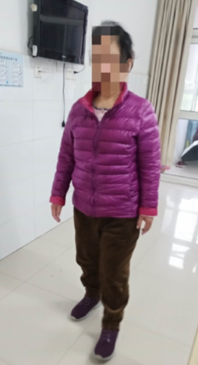 张阿姨2.png