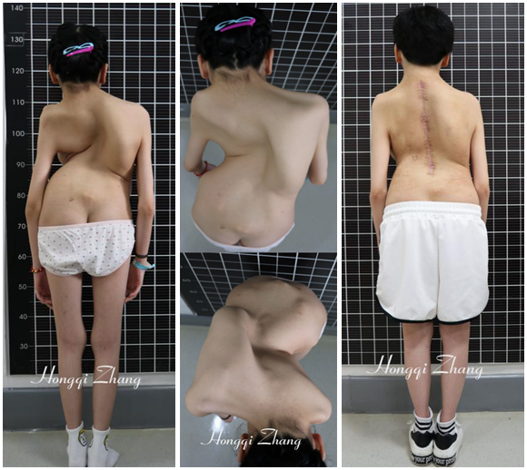 02 患者术前（左、中）及术后（右）大体像.png