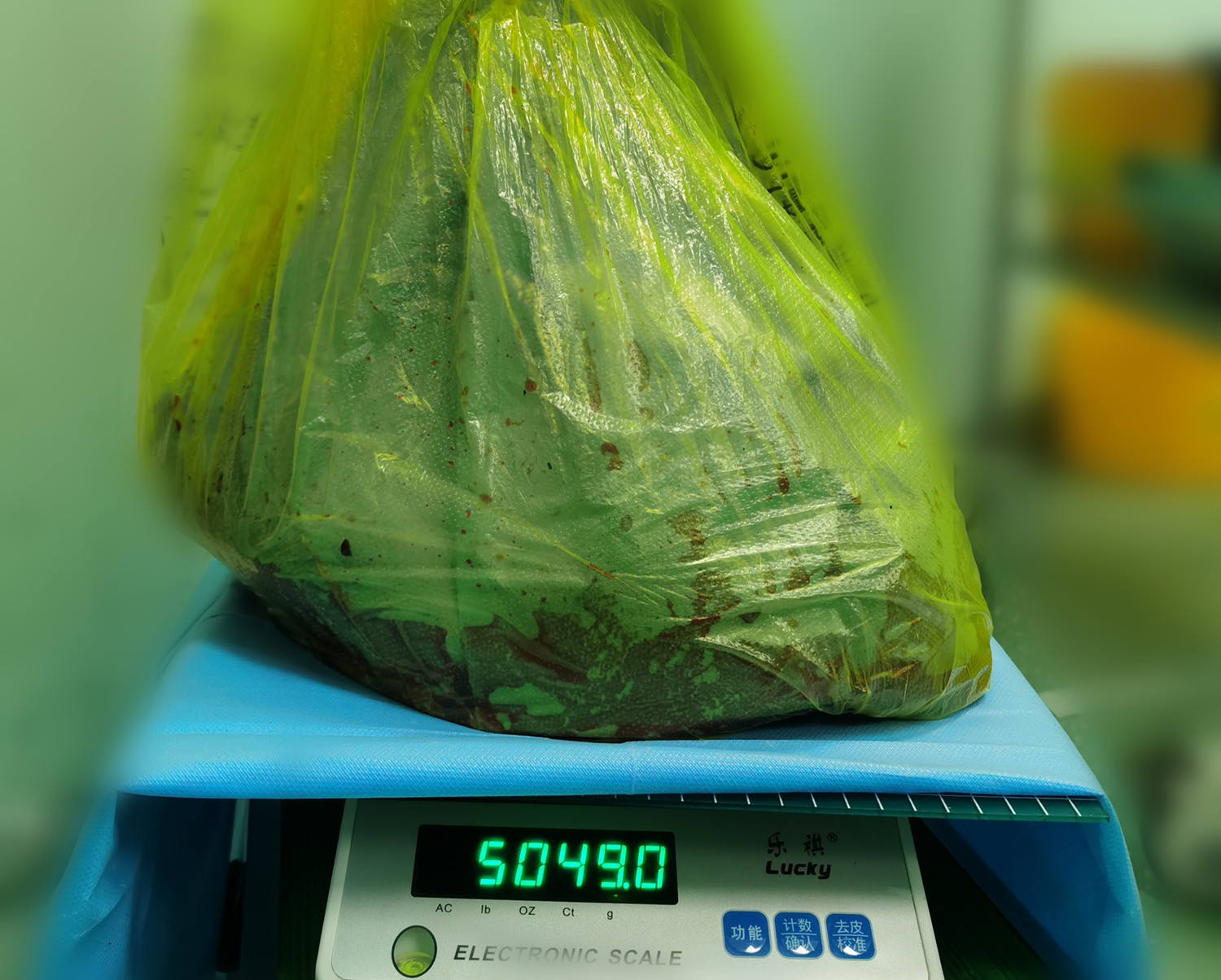 切除的肿瘤重达5049g。.jpg