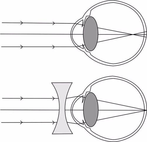 u=3197211087,3124371173&fm=26&gp=0.jpg
