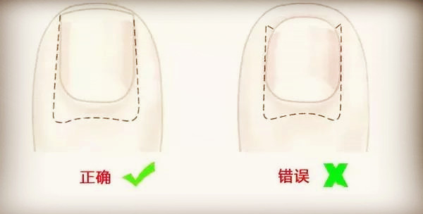 v2-a10e8b4ccb6d20e9957286bd22d0338e_720w.jpg