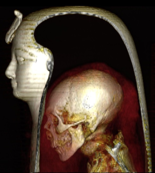 Eurekalert