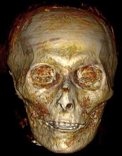 Eurekalert